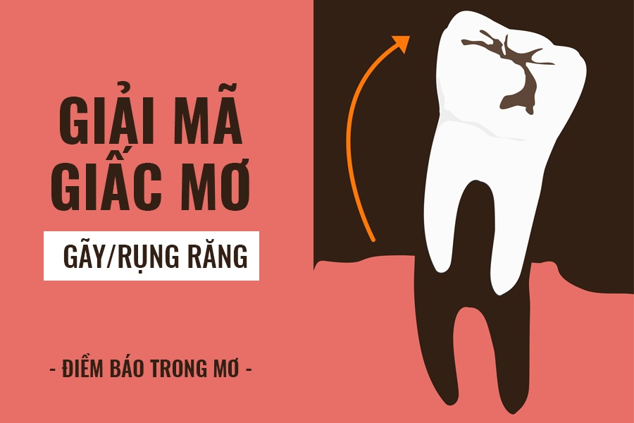 May88 VIP giải mã giấc mơ rụng răng